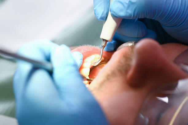 Best Broken or Cracked Tooth Emergency Dentist in Winlock, WA