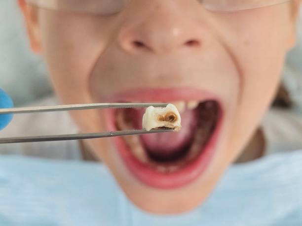 Best Emergency Dental Services for Seniors in Winlock, WA