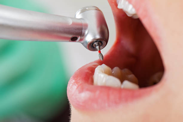 Best Emergency Cosmetic Dentistry in Winlock, WA